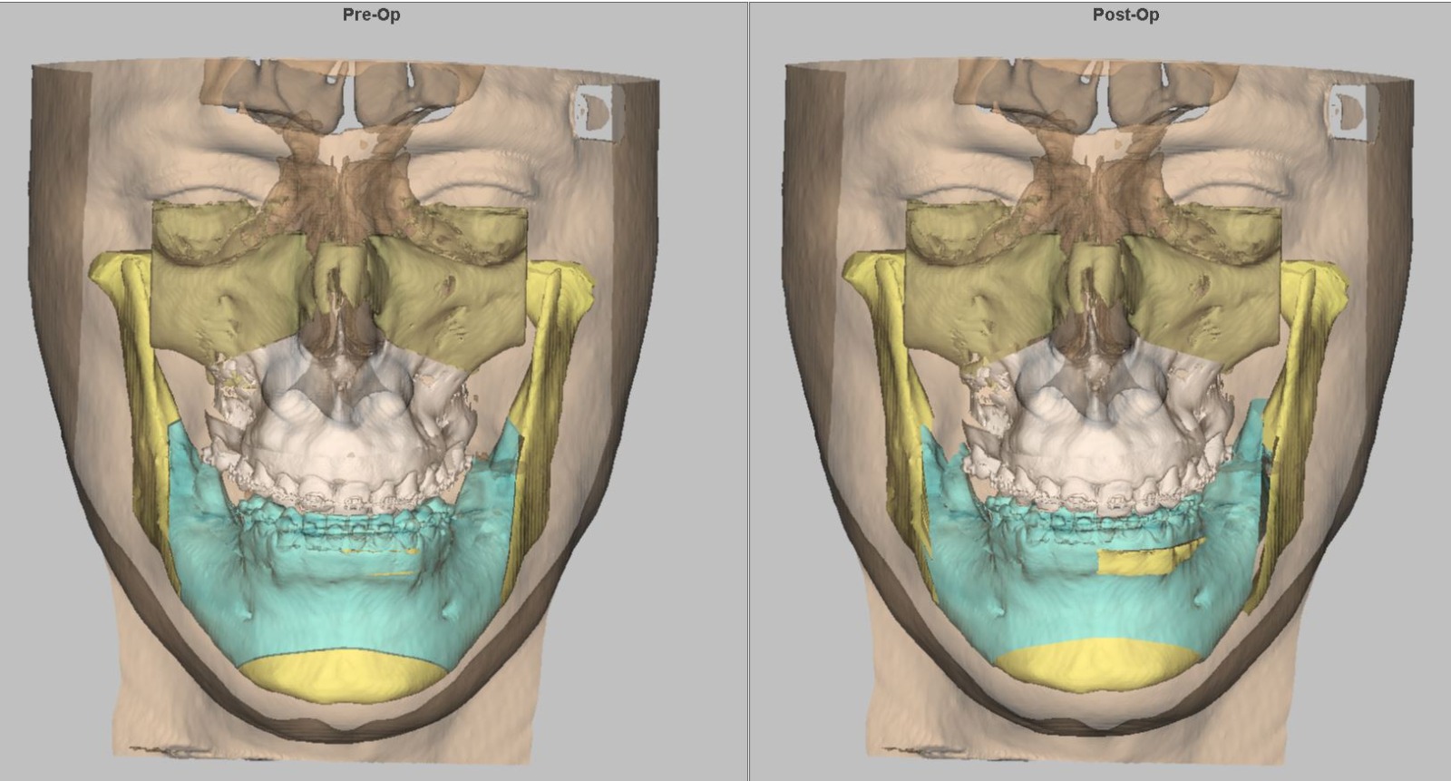 Tomografia Dental 3D