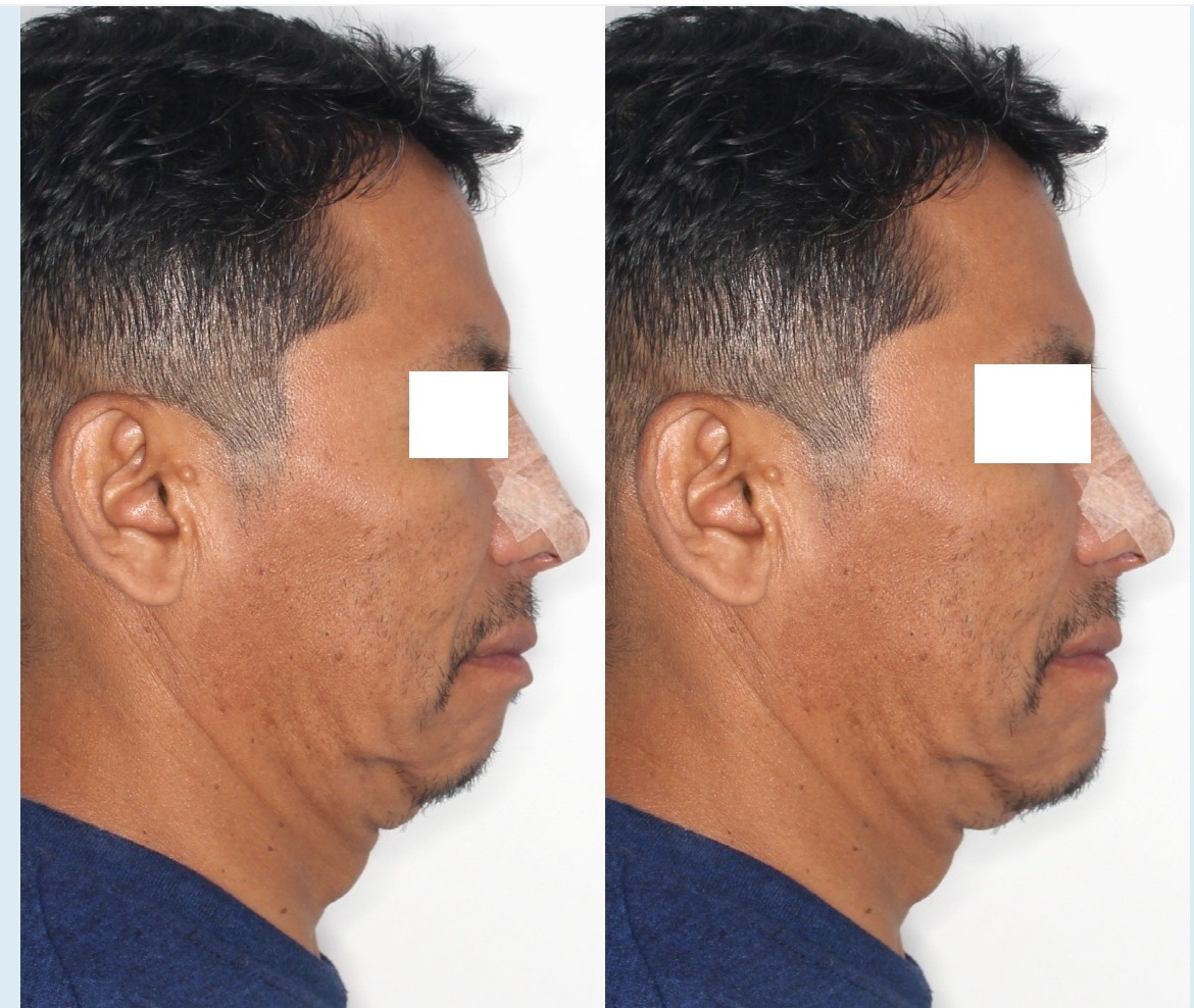 Radiografías Extraorales